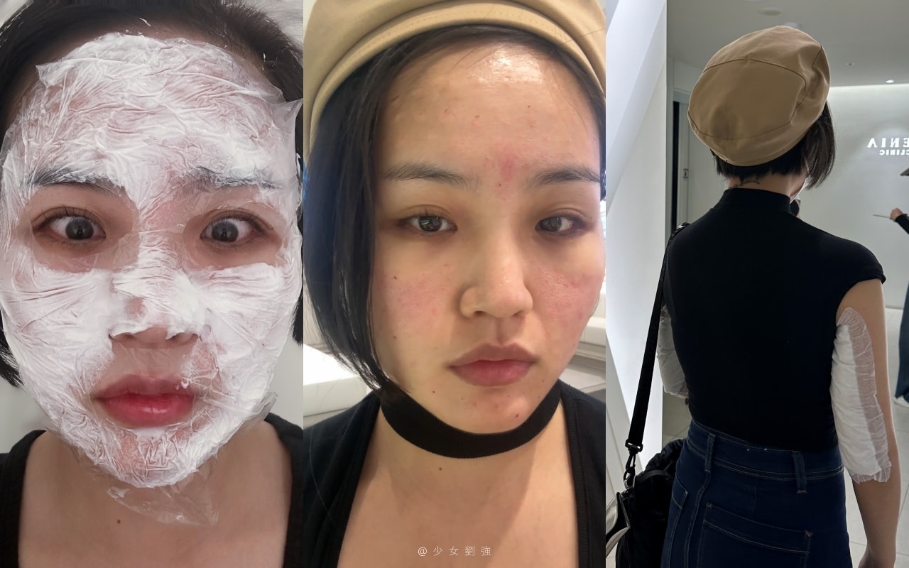 韓國醫美推薦 韓國江南詩麗雅診所 韓國醫美價格? 韓國醫美項目 超聲刀是什麼? - 第5張圖 韓國醫美初體驗:韓國江南詩麗雅診所